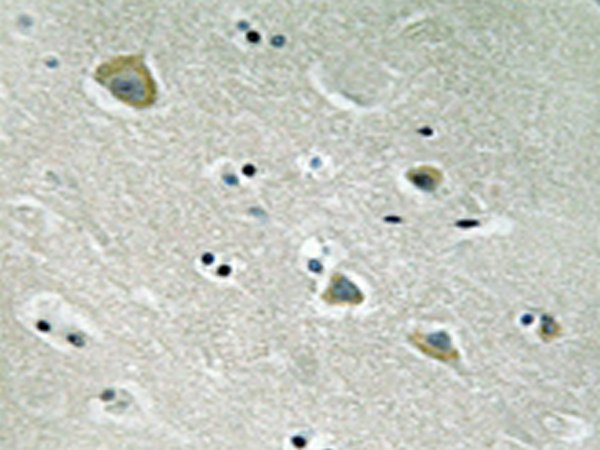 兔抗PAK1(Phospho-Ser204) 多克隆抗体
