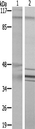 兔抗VAV1(Ab-174)多克隆抗体 
