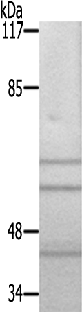 兔抗PAK123(Ab-423402421)多克隆抗体