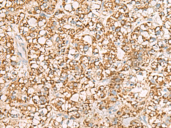 兔抗ISOC2多克隆抗体