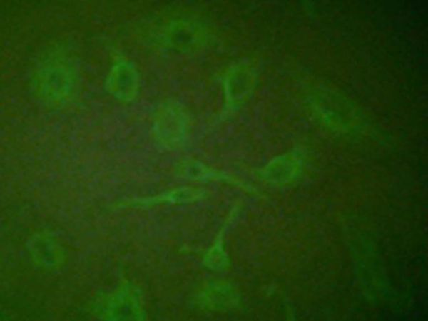 兔抗SCGB2A2多克隆抗体 