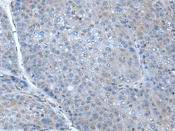 兔抗SCGB3A1多克隆抗体