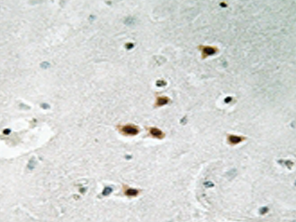 兔抗ITCH(Phospho-Tyr420) 多克隆抗体 