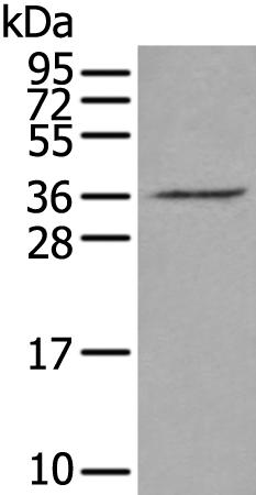 兔抗VGLL2多克隆抗体