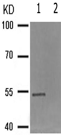 兔抗VIM(Phospho-Ser56) 多克隆抗体 