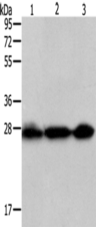 兔抗PDCD10多克隆抗体