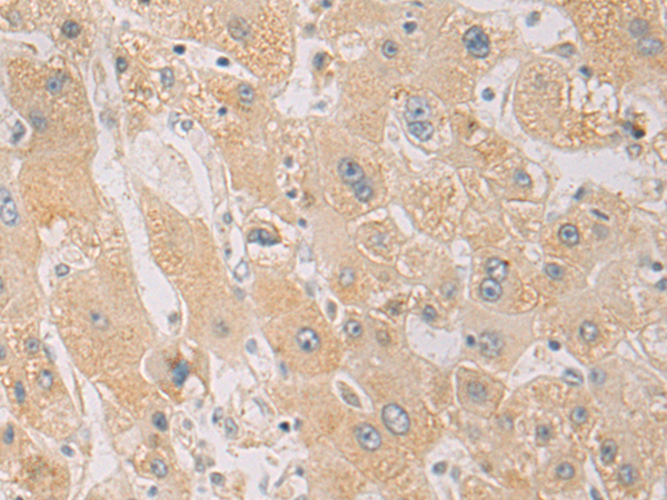 兔抗PDCD1LG2多克隆抗体