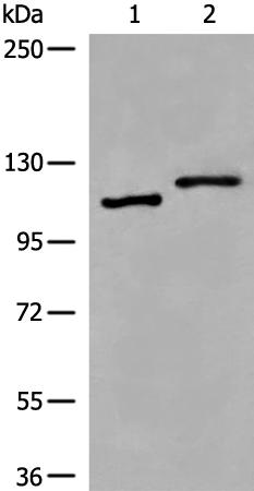 兔抗VPS18多克隆抗体   