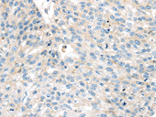 兔抗VPS26A多克隆抗体 