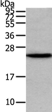 兔抗VPS28多克隆抗体 