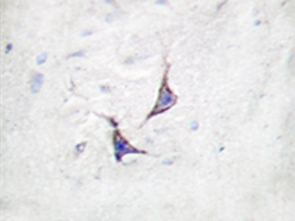 兔抗SDC4(Ab-179) 多克隆抗体