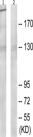 兔抗ITGB4(Phospho-Tyr1510) 多克隆抗体