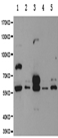 兔抗PDE1B多克隆抗体