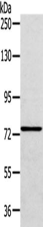 兔抗VPS53多克隆抗体   