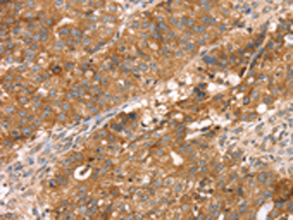 兔抗PDLIM4多克隆抗体