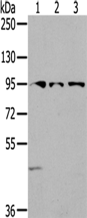 兔抗SEMA6A多克隆抗体