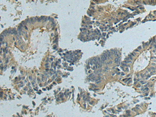 兔抗SEMA6D 多克隆抗体