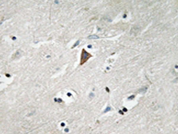 兔抗PDPK1(Phospho-Tyr9) 多克隆抗体