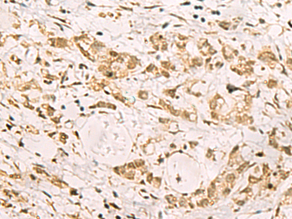 兔抗PDS5A多克隆抗体