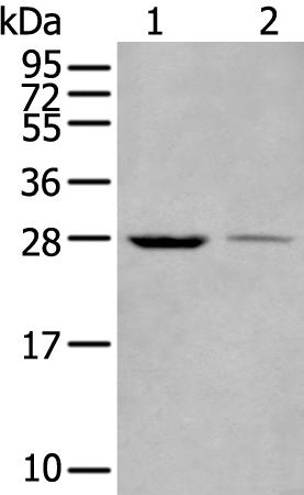 兔抗WBP1多克隆抗体