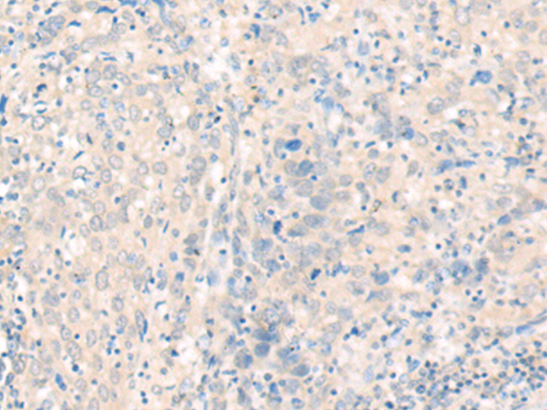 兔抗PDZD3多克隆抗体