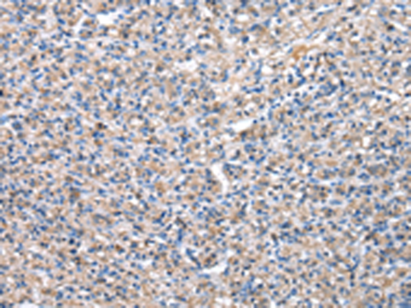 兔抗PDZK1多克隆抗体