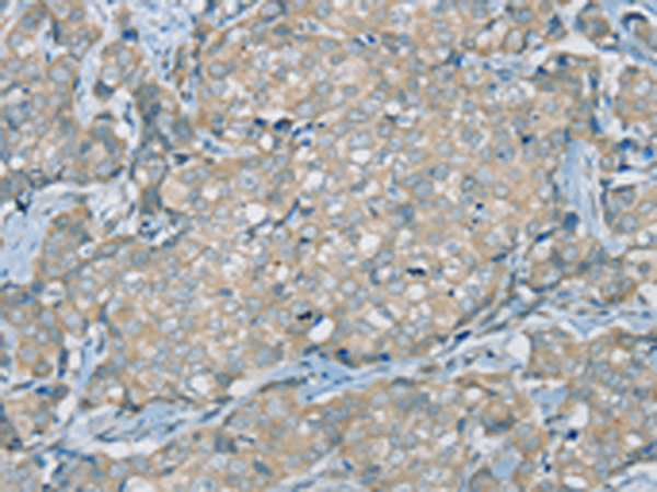 兔抗SERPINA11多克隆抗体 
