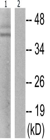 兔抗JUN(Phospho-Ser63) 多克隆抗体 