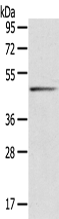 兔抗SERPINB8多克隆抗体