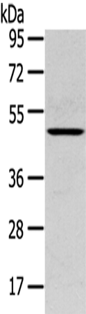 兔抗SERPINB11多克隆抗体