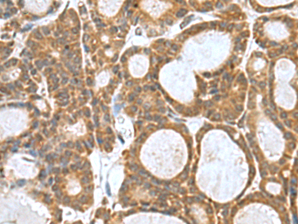 兔抗KANSL1L多克隆抗体 