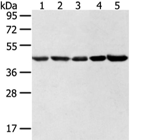 兔抗WDR77多克隆抗体 