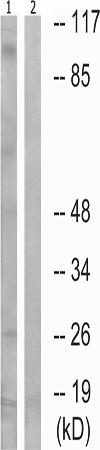 兔抗WEE1(Phospho-Ser642) 多克隆抗体
