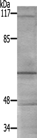 兔抗SF1(Ab-82) 多克隆抗体