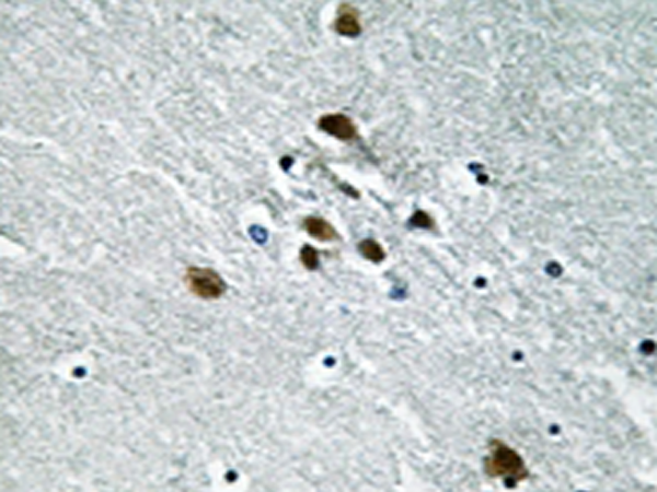 兔抗SF1(Phospho-Ser82) 多克隆抗体