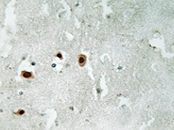兔抗KAT5(Phospho-Ser90) 多克隆抗体 