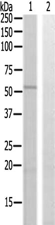 兔抗WIPF1多克隆抗体  