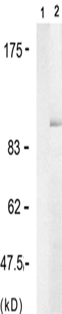 兔抗PGR (Phospho-Ser190)多克隆抗体
