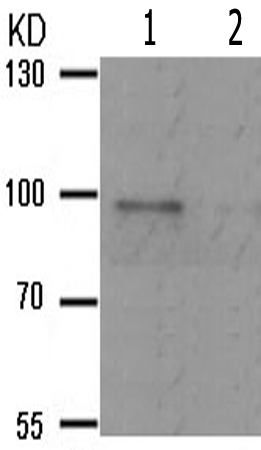 兔抗PGR(Phospho-Ser294)多克隆抗体