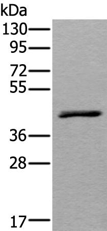 兔抗WSB2多克隆抗体 