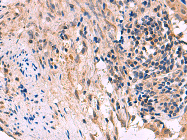 兔抗KCNIP1多克隆抗体