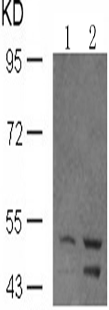 兔抗SHC1 (Phospho-Tyr349)多克隆抗体