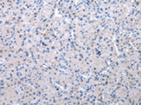 兔抗XKR6多克隆抗体 