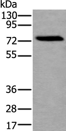 兔抗XPNPEP2多克隆抗体