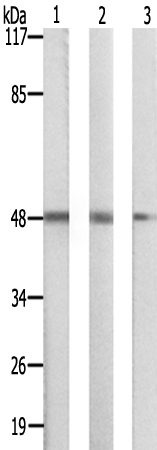 兔抗SIRPB1多克隆抗体