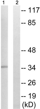 兔抗YBX1(Phospho-Ser102) 多克隆抗体