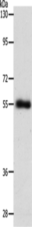  兔抗SLC1A5多克隆抗体