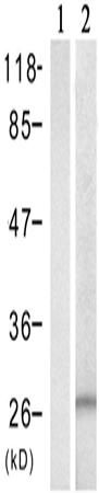 兔抗YWHAZ (Phospho-Ser58)多克隆抗体    