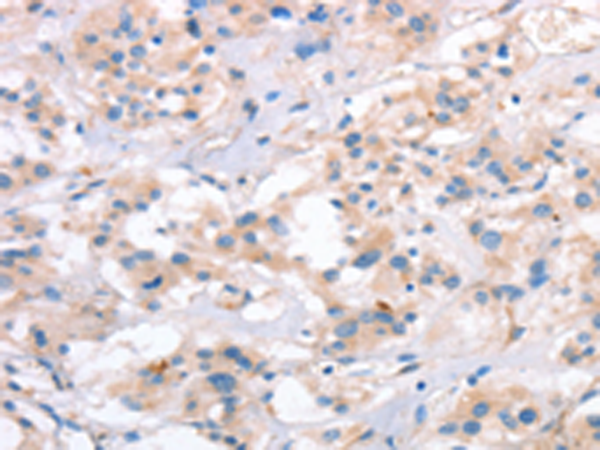 兔抗SLC4A1多克隆抗体