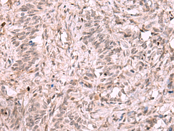 兔抗KDM7A多克隆抗体